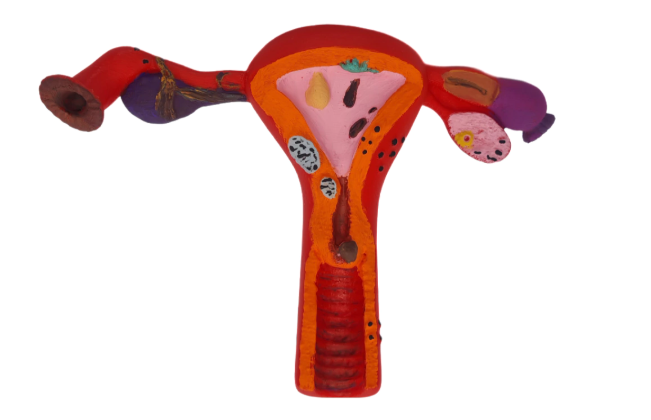 Modelo Patolgico do tero  Tamanho Real